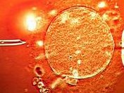 多囊在马来西亚哥伦比亚亚洲医院做三代试管的步骤有哪些？三代试管攻略大全