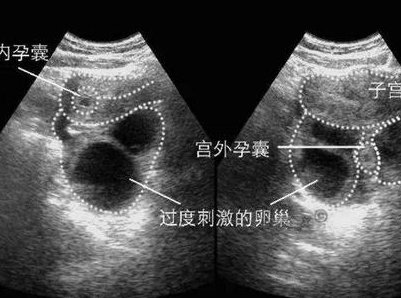2026年南昌三代试管医院盘点，这几家都值得信赖