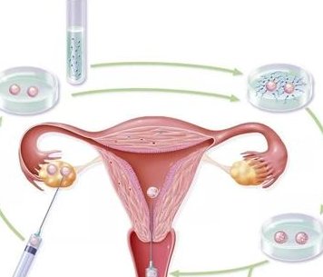 香港三代试管婴儿哪家医院比较好成功率高？本文详细介绍了7个调查维度